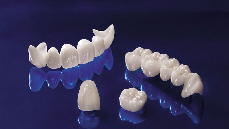 Các loại răng sứ thường được sử dụng hiện nay