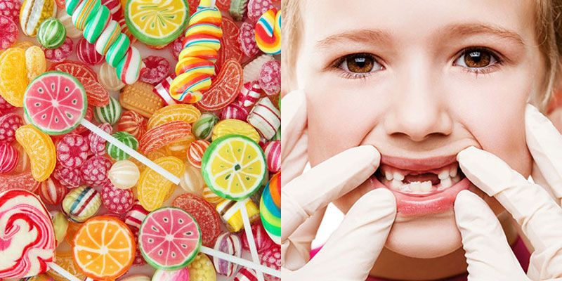 Ăn nhiều đồ ngọt là nguyên nhân gây ra các bệnh lý răng miệng