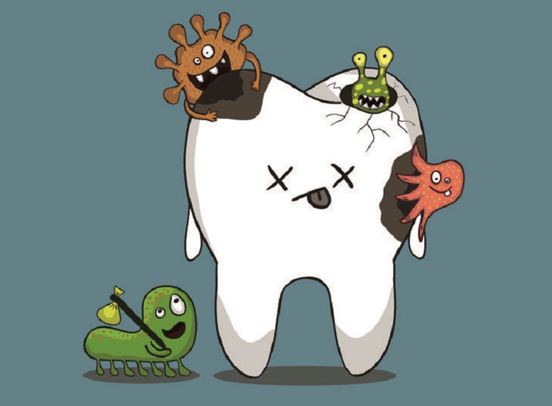 Nhiễm khuẩn răng miệng nếu không được chữa trị kịp thời sẽ rất dễ bị mất răng vĩnh viễn