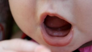 Trẻ chậm mọc răng nguyên nhân do đâu