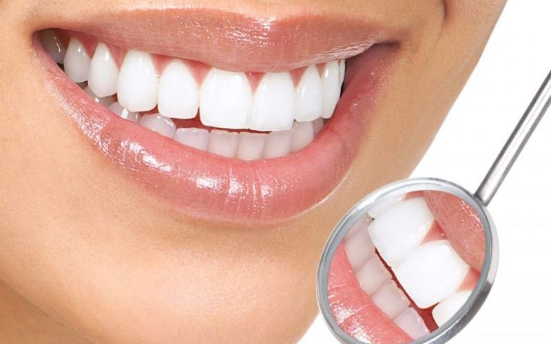 cNên niềng răng hay bọc răng sứ phụ thuộc vào tình trạng của từng người