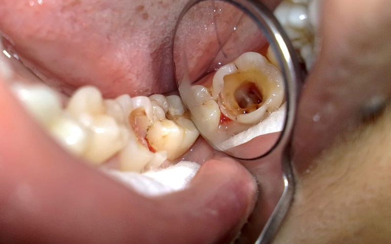 Bệnh nhân gặp các vấn đề về răng miệng sẽ tốn thời gian hơn