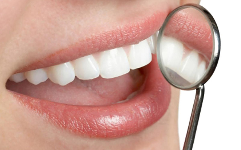 Bọc răng sứ trả góp là hình thức mang tới nhiều lợi ích cho khách hàng
