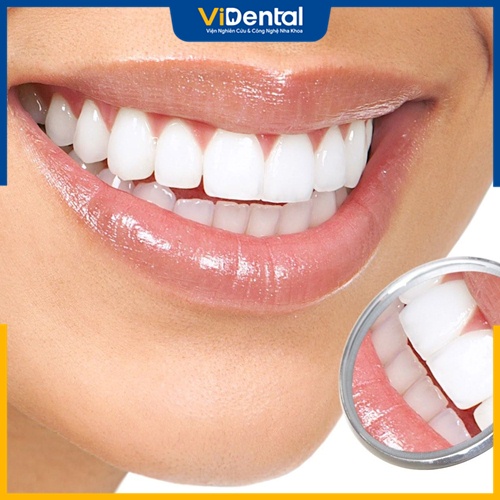 Bọc răng sứ trả góp là cách được nhiều bệnh nhân lựa chọn