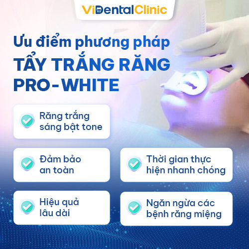Công nghệ tẩy trắng răng ViDental đang áp dụng