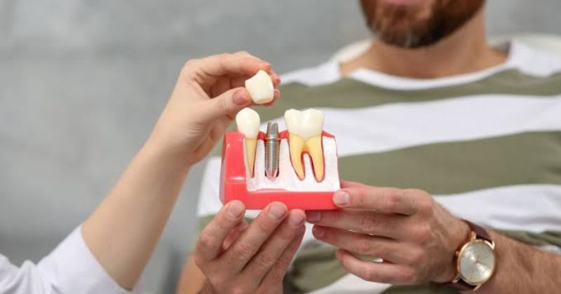 Ai nên chọn trồng răng Implant Straumann Thụy Sĩ