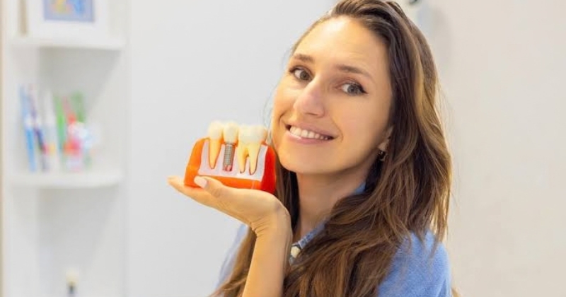 Chăm sóc răng sau khi cắm implant