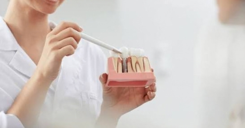 Hướng dẫn chăm sóc trong 24 giờ đầu sau phẫu thuật cắm implant
