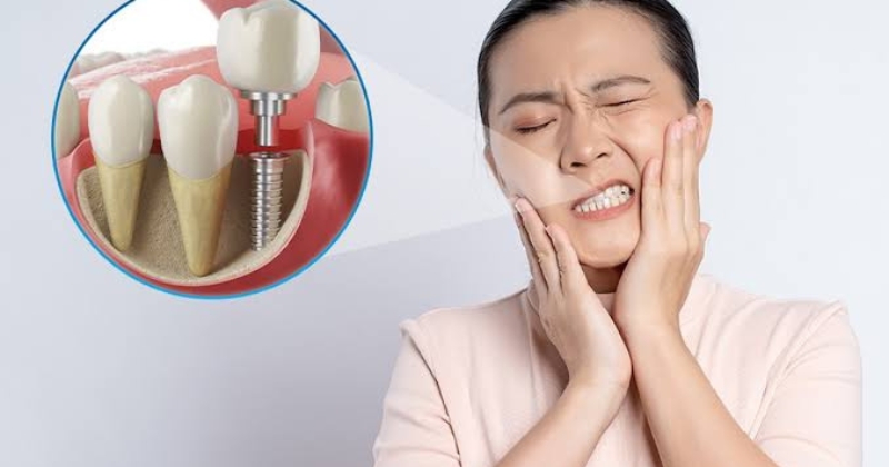Mẹo mách bạn cách giảm đau và giảm sưng nhanh sau khi cấy Implant tại nhà