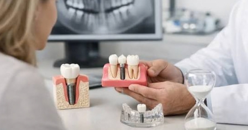 Những ai nên và không nên cấy răng implant