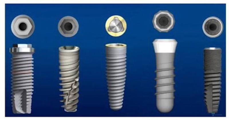 Phân loại các loại implant theo phân khúc xuất xứ