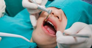 Quy trình trồng răng Implant chuẩn y khoa