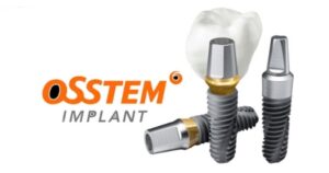 Trụ Implant Osstem Hàn Quốc