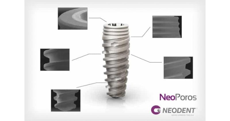 Ưu nhược điểm của trụ Implant Neodent