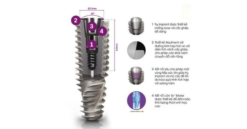 công nghệ đột phá trên trụ răng Implant Neodent
