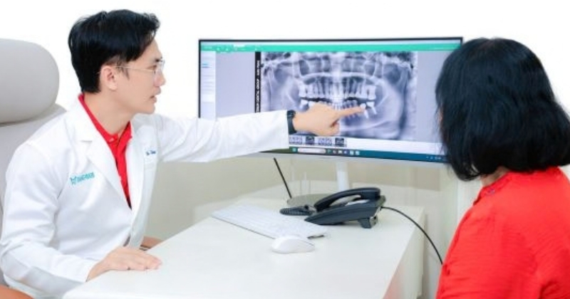 thời gian trồng răng Implant qua 2 giai đoạn